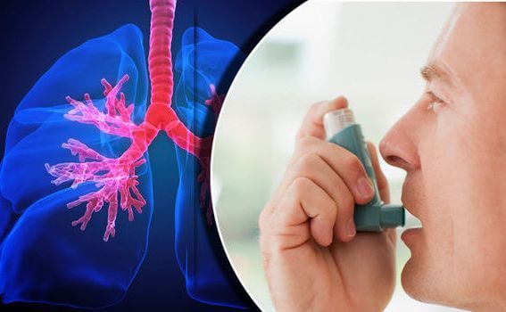 Asthma Treatment In Deoria